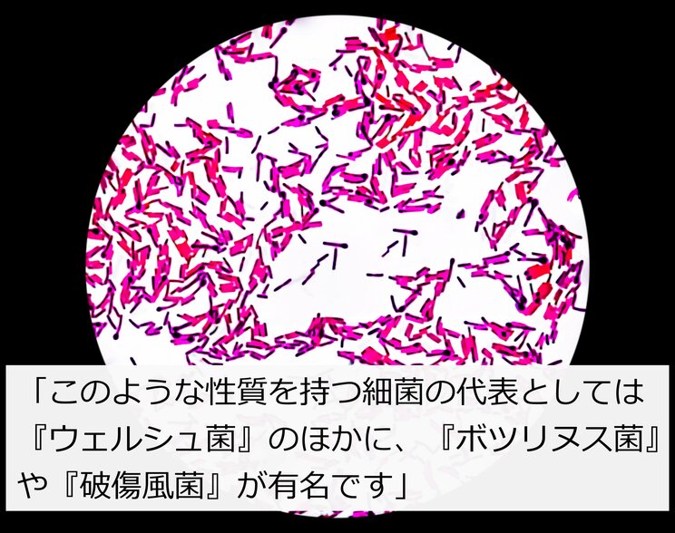 「２日目のカレー」が危険すぎる食べ物に変わるとき…火にかけても死滅しない、煮込み料理に潜む“死”の細菌とは…_6