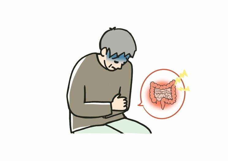 〈大腸がんの８つの初期症状チェック〉赤い便、黒い便、下痢・便秘…日々の体調チェックでわかる！  大腸がんの9割を占める「大腸ポリープ」のサインとは_2