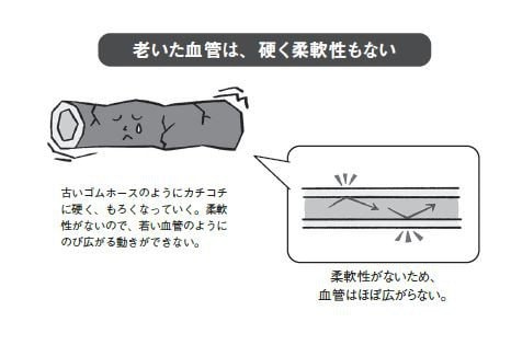 体が硬くなった人は動脈硬化が進んでいる?！　血圧と冷えだけじゃない。体の硬さは、血管の健康を守る重要なバロメーター_2