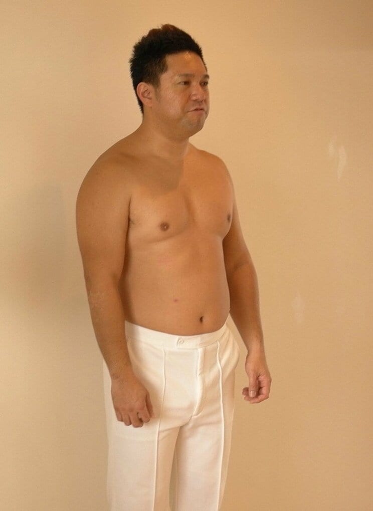 激太りした時のパッション屋良（写真／本人提供）