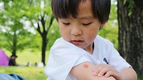 子どもは大人より腫れやすい! 虫刺されの予防&おうちケアのコツ
