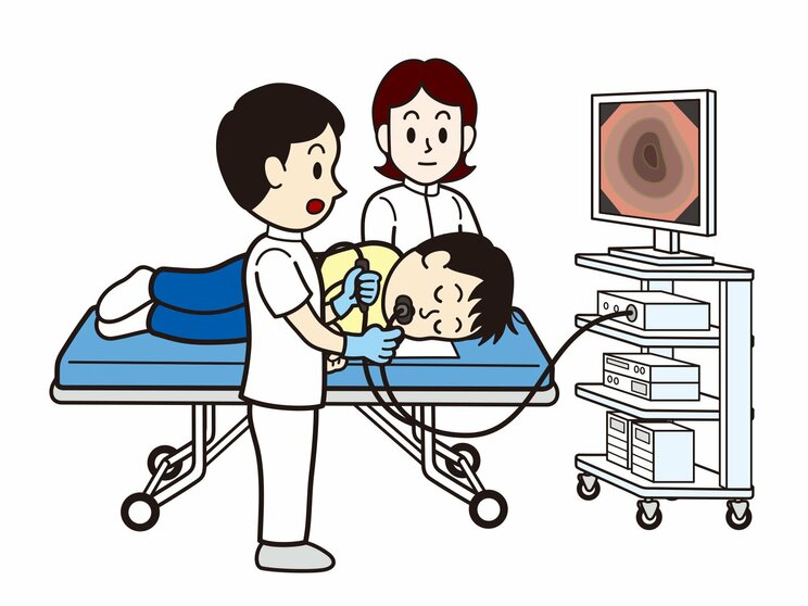 《逆流性食道炎を防ぐ５つの改善》成人の5人に1人が罹患する食道がんのリスクを高める現代病…食後すぐに横になる、辛いものが好き、肥満よりも気をつけたい悪習慣とは_3