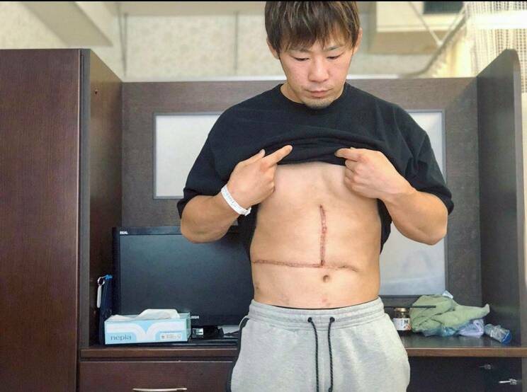 術後には大きな傷を残すことになった