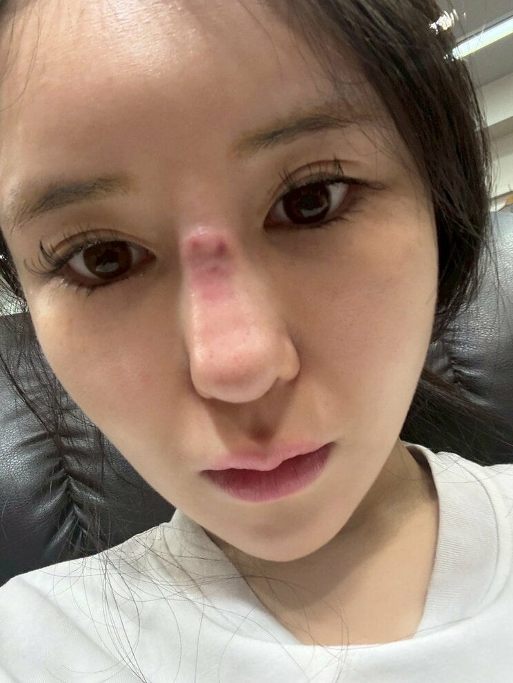 整形でトラブルに