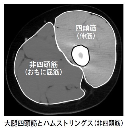 大腿四頭筋とハムストリングス（非四頭筋）の画像。『百歳まで歩ける人の習慣 脚力と血管力を強くする』より