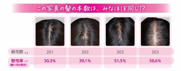 
※2:頭頂部脱毛部位の周辺の1㎠の毛髪数を測定

※3:軟毛率:1㎠あたりの総毛数における軟毛数の割合（軟毛数/総毛数）本試験における軟毛:太さ40㎛未満の細い髪の毛

写真／大正製薬提供
