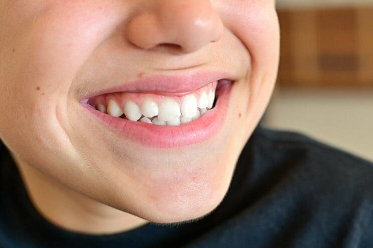 口を閉じているとき、無意識に奥歯が当たっていませんか？　歯の天敵「TCH」の噛みグセが歯を失うリスクが増大させている！_2