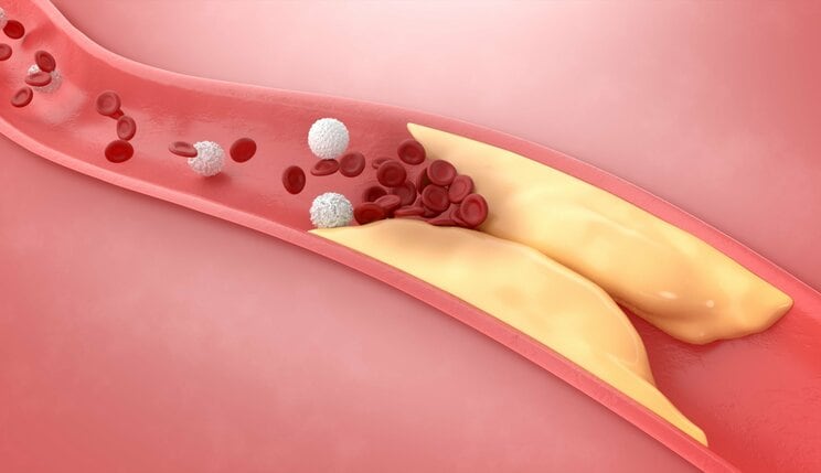 塩分の摂りすぎで高血圧になる、コレステロールは悪者、は本当？ 薬剤師が教える、案外知られていない血圧対策_3