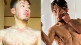 「病気が治れば幸せになれると思っていた」余命3カ月宣告から復帰した格闘家が直面した“見えない苦しみ”と社会とのズレ