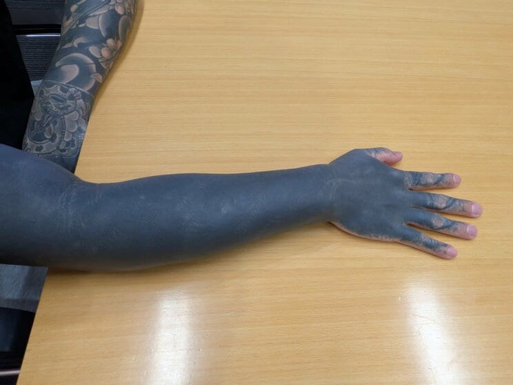 右腕は和彫りを黒くカバーアップしている