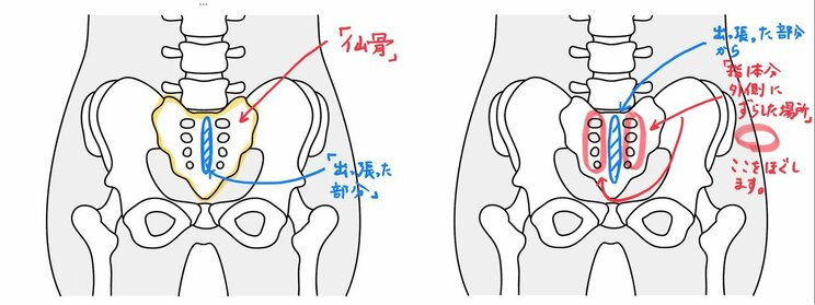 つらい膝の痛みの原因は座り方にあった？　温めてもマッサージしても治らない膝痛のためにほぐすべき意外な部位_5