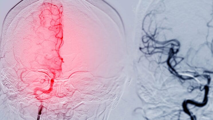 写真はイメージです(写真/Shutterstock)