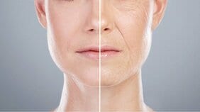 肌の老化を加速させる最大の原因は紫外線じゃない? 同年齢なのに「見た目の違い」を生んでしまう糖化と酸化の悪循環とは