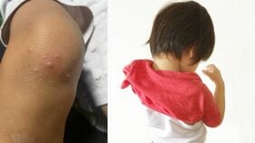 〈0歳児を段ボール箱で隔離〉手足口病の園児への対応に「虐待が疑われる不適切保育」と指導…仕事と家庭の両立に追われる共働き世帯と保育園との間に対立はあるのか?