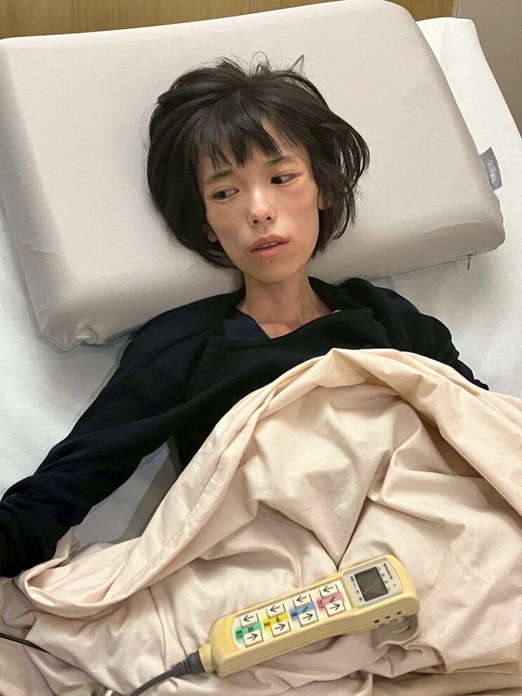 釈放後、やせて衰弱したるなさん（仮名）　※「亡くなる前の状態を知ってほしい」との遺族の意向で顔を隠さず公開します（写真／遺族提供）