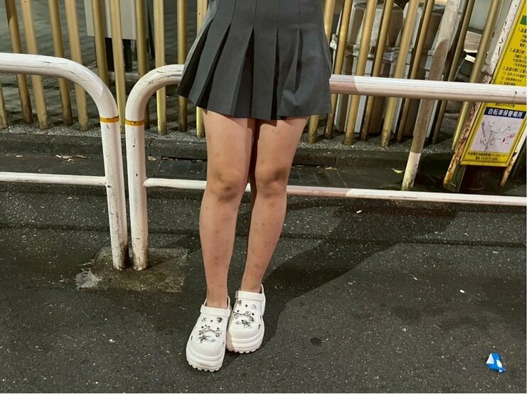 大久保公園に立つＡさん（撮影/集英社オンライン）