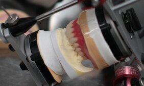 「これからどれだけ歯科技工士が減るかを考えると恐ろしい」すでに20年で4000人以上が減少…その衝撃の理由とは