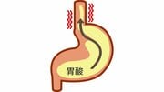 《逆流性食道炎を防ぐ5つの改善》成人の5人に1人が罹患する食道がんのリスクを高める現代病…食後すぐに横になる、辛いものが好き、肥満よりも気をつけたい悪習慣とは