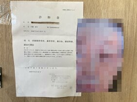 〈狛江90歳殺害事件との関連は?〉「『金庫はどこだ?』と尋ねられ、殴る蹴るの後、消火器を撒かれた」「現場付近ではお金が舞っていた」捜査のカギとなる2つの強盗事件の詳細