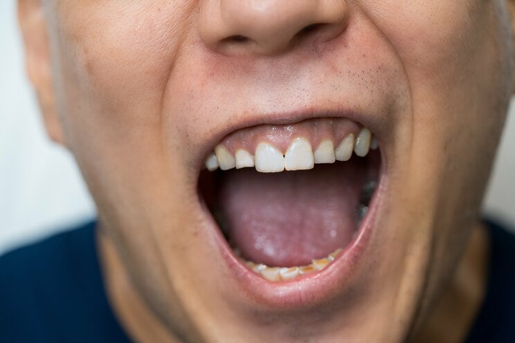 写真はイメージです（写真／Shutterstock）