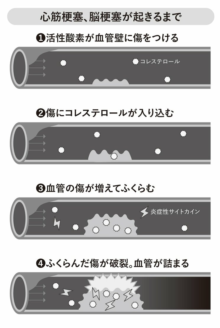 書籍　『倍速老化』より