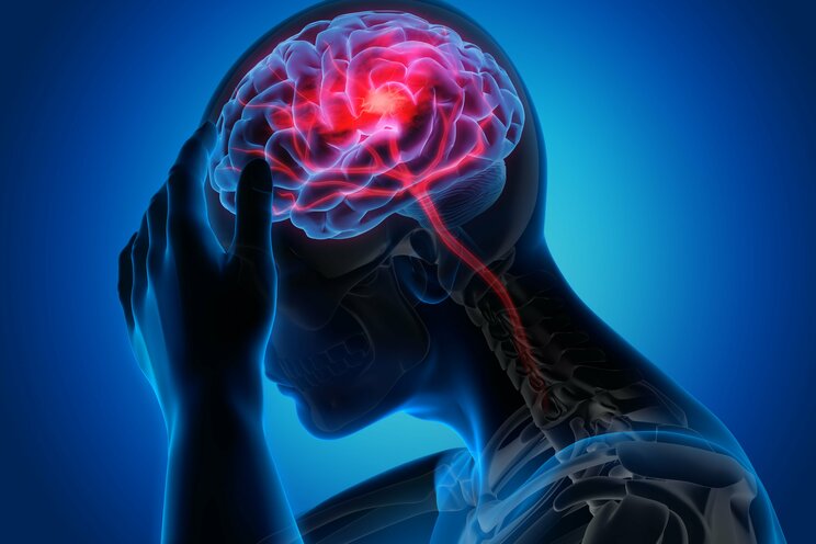この３タイプの頭痛の原因は「筋肉のこわばり」。頭痛薬に頼りがちな人に試してもらいたい、ちょっと意外な解消法とは？_2