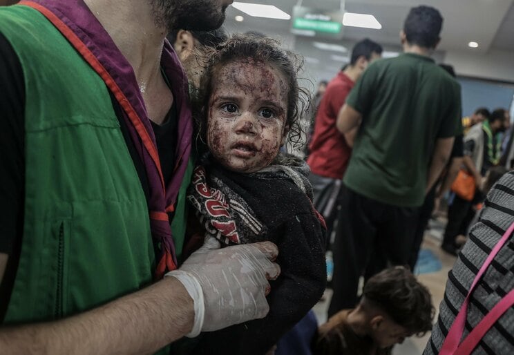 ガザの病院爆発で負傷し、別の病院に搬送される人々　写真／ゲッティ・共同イメージズ