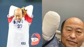〈このままだと5年しか生きられない〉右腕切断も合併症の脅威おさまらず…“ピッカリ投法” 佐野慈紀さんが明かす糖尿病の恐ろしさ