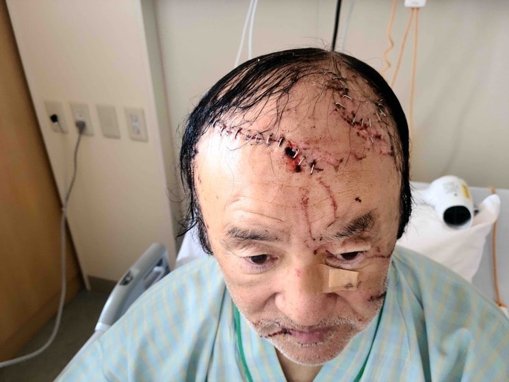 生きているのが奇跡と思えるほどの深い傷