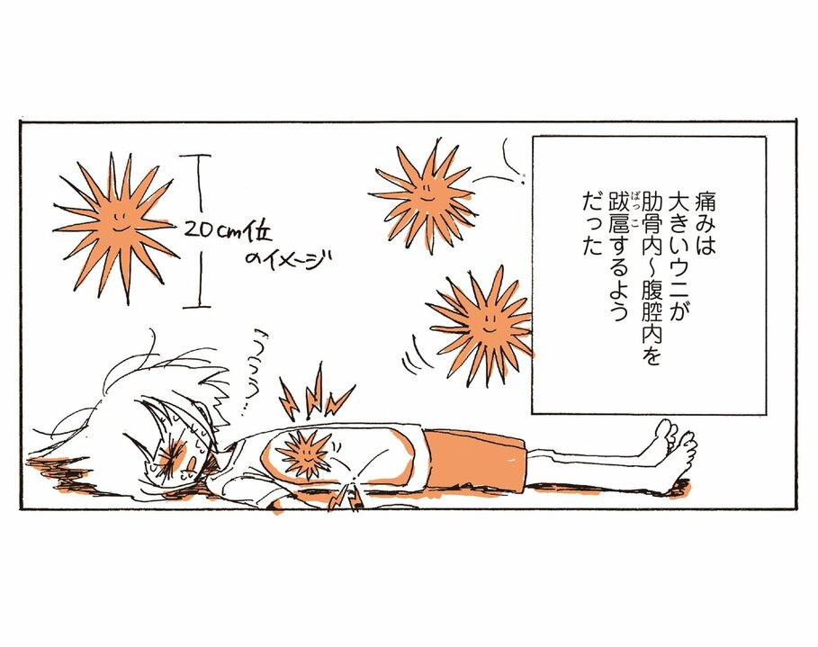 【漫画】大きなウニが体内で暴れるような「痛み」「吐き気」「熱」。急性膵炎の三重苦に悶える入院生活が始まる(2)_14