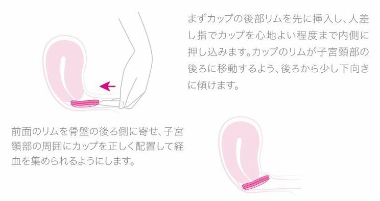 生理中でもセックスできる。最先端のフェムテック「月経ディスク」が日本上陸！_5