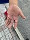 滝野氏の手、傷跡が痛々しかった(撮影/集英社オンライン)