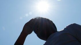 強烈な紫外線は髪を細くし、秋の抜け毛の原因に。夏の間にやっておきたい抜け毛・薄毛を防ぐケア