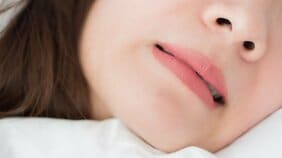 大切な歯を失ってしまうかもしれない“ブラキシズム”とは? 「原因不明の偏頭痛」「犬歯の尖りがなくなった」「歯の付け根にくぼみ」の兆候には要注意