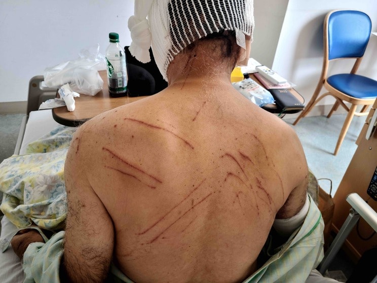 「人が襲われ骨だけ残された例も…」目撃情報は例年の8倍、市職員の装備はヘルメットと盾、スプレーだけ、追いつかない駆除の実状〈秋田“クマ被害”が限界〉_6