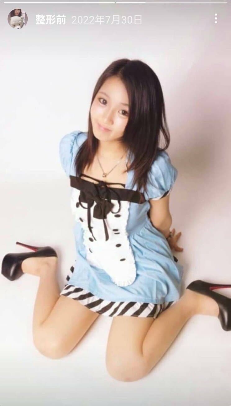 整形する前の、みみたん