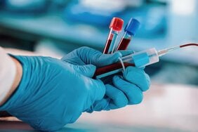 【人間ドックの日】日本人の3割は未受診。人生後半の健康を左右する人間ドックは受けるべき? アメリカでは一部の富裕層しか受けられず