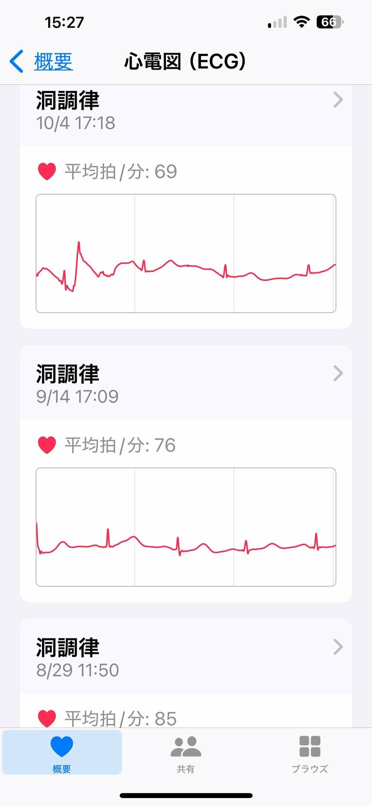 測定した心電図はすべてデータとして記録される