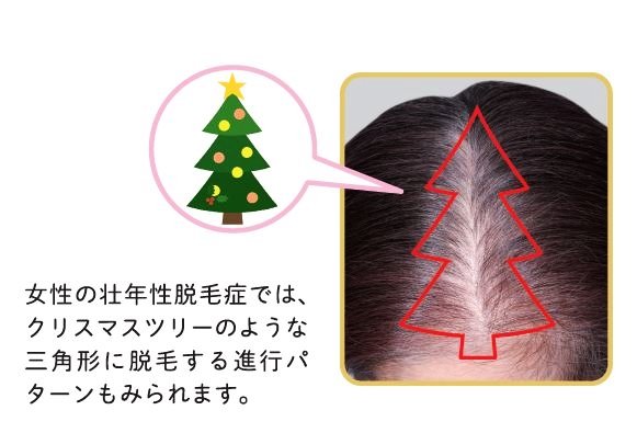 写真／大正製薬提供