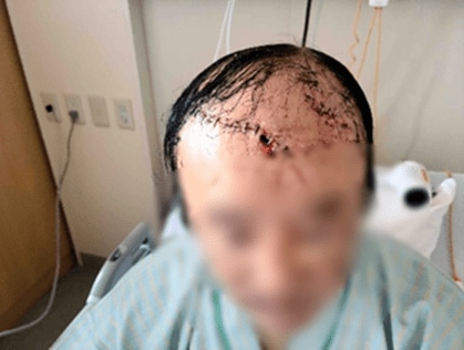 決死の体当たりでヒグマを撃退した82歳老婆から学ぶべきこと…積丹町「副議長VS猟友会」収束も、人間が争っている場合なのか?_4