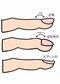 スプーン爪、テリー爪、…爪が知らせる思わぬ不調のシグナル_02