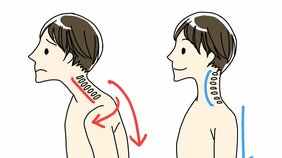 疲れがとれにくい、呼吸がしづらい、肩こりや頭痛がよくおきる…は「巻き肩」が原因だった! スマホやPCを見る姿勢が体調を左右するつらい現実