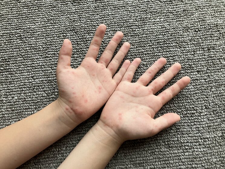子どもだけでなく大人も注意が必要（写真AC）