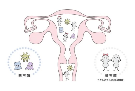 自宅で「妊娠力」を測定したら衝撃の結果が！　31歳、妊活中のライターが「子宮内フローラCHECK KIT」を試してみた！_1