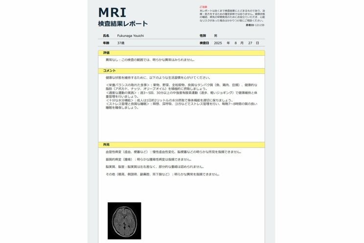 筆者の検査結果：幸いなことに、異常なしだった　著者提供