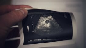 高校生で妊娠・中絶を経験した女子大生が問う「悪いのは私だけ?」【理想の性教育とは】