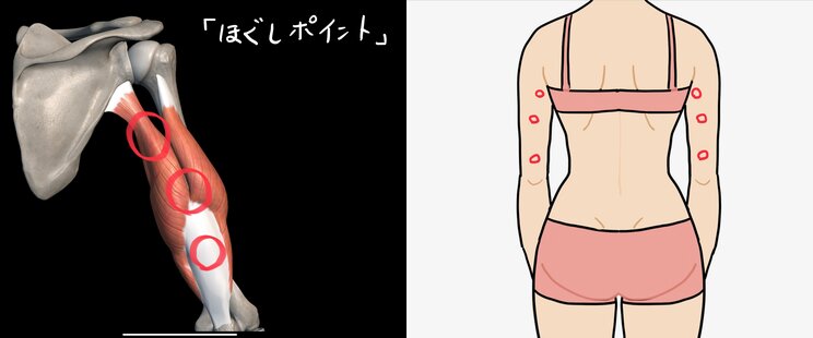 スマホを使い過ぎて、腕が悲鳴!?　まるで四十肩のような症状…若い世代でも肩が上がりにくくなってしまうのはなぜ？_3