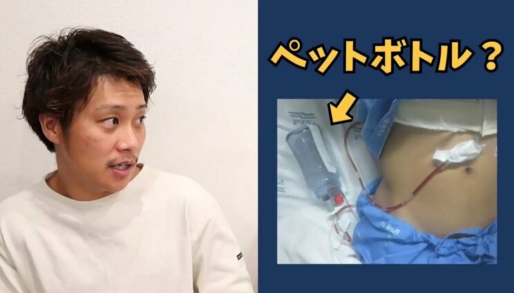 YouTubeチャンネル「ジーピットチャンネル」にて手術の様子を語る井上さん（本人YouTubeチャンネルより）