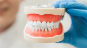 「歯磨きしない方が健康？」常識を覆した“旧石器食”のヤバすぎる結果「４週間歯を磨かなかったにもかかわらず、口腔内環境全体が改善された」