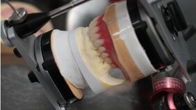 〈歯科技工士たちが告発〉「もう限界だ…」歯科医によるダンピング、後継者不足、無責任な厚労省…「虫歯の再発は歯磨きのせいとは限らない」「業界の構図に問題がある」このままでは“入れ歯難民”が続出か